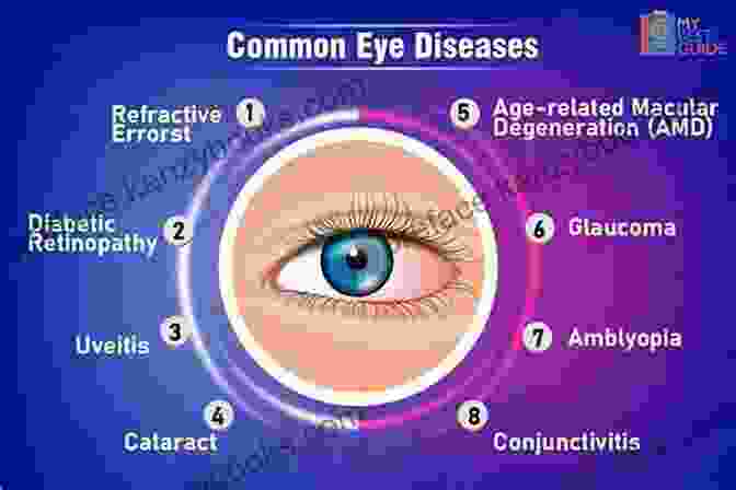 Comprehensive Guide To Ocular Defects And Spectacles, Covering Causes, Symptoms, And Corrective Measures. The Theory Of Ocular Defects And Of Spectacles